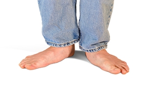 Facts About Acquired Flat Feet