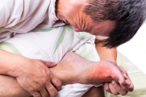 Facts About Gout